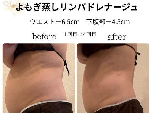 LOTUS腸+肌の画像